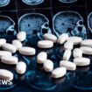 NHS will not fund new drug to slow Alzheimer’s