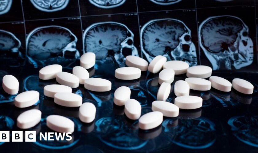 NHS will not fund new drug to slow Alzheimer’s