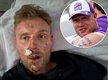 Freddie Flintoff to relive horror of Top Gear crash that saw hit BBC show axed in gritty new feature-length documentary