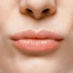 How to heal chapped lips, according to experts