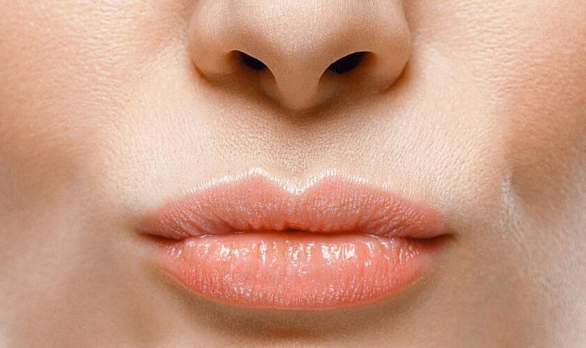 How to heal chapped lips, according to experts