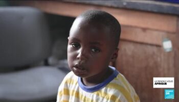 RD Congo : les enfants particulièrement touchés par l'épidémie de Mpox