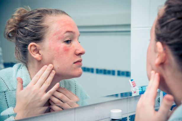 'I'm a doctor - these four common eczema myths are completely untrue'