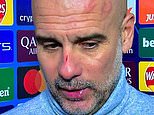 Pep Guardiola speaks for the first time after appearing with cuts and marks on his face and joking about 'self-harm'