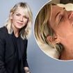 Zoe Ball reveals she has been battling a painful health condition after announcing her departure from £950,000 role as BBC Radio 2 Breakfast show host