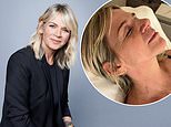 Zoe Ball reveals she has been battling a painful health condition after announcing her departure from £950,000 role as BBC Radio 2 Breakfast show host