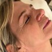 What is TMJ disorder? Zoe Ball reveals painful condition