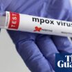 First known US case of person infected with new mpox strain reported