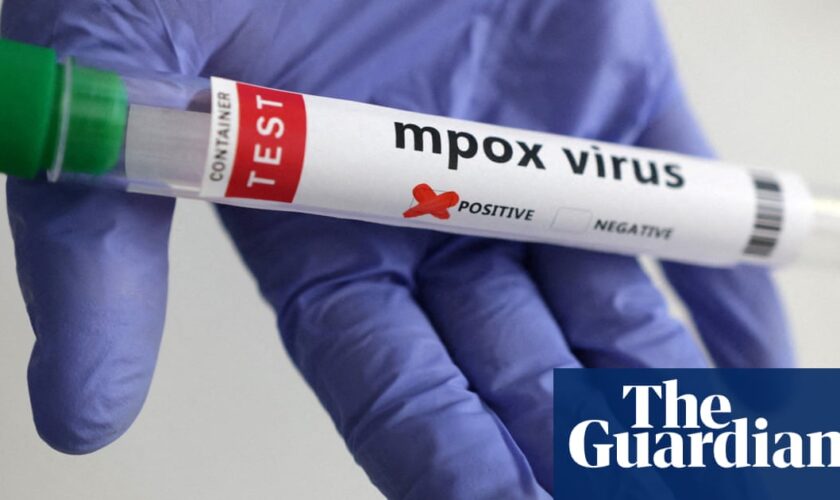 First known US case of person infected with new mpox strain reported