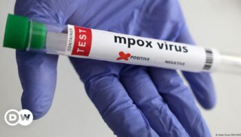 US reports first case of new mpox variant