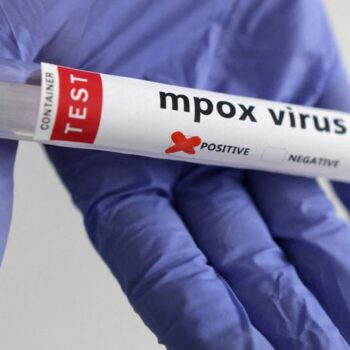 US reports first case of new mpox variant