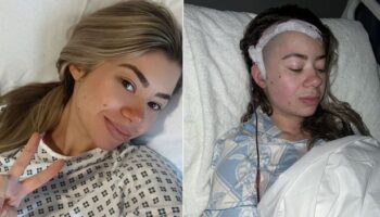 'I went blind after doctors dismissed failing sight as migraines - then they found a brain tumour'