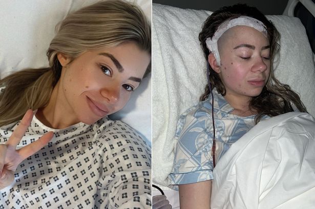 'I went blind after doctors dismissed failing sight as migraines - then they found a brain tumour'