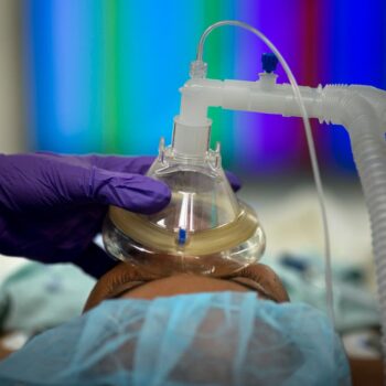 How much does an hour of anesthesia cost? Blue Cross Blue Shield says they will cap coverage after a certain time - whether your surgery is done or not