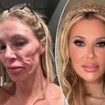 Botched surgeon issues urgent warning to Brandi Glanville and shares new theory about her 'parasite' face