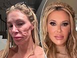 Botched surgeon issues urgent warning to Brandi Glanville and shares new theory about her 'parasite' face