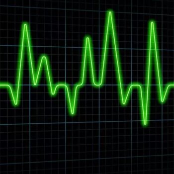 'Artificial Intelligence reading ECGs to predict heart attacks and patient deaths'