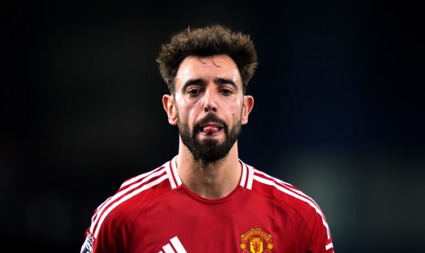 Bruno Fernandes urges United to forget City’s problems and focus on own issues