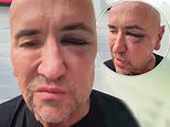 DJ Fat Tony reveals shocking facial injuries after being attacked 'by a fellow DJ' at gig and says he's 'gutted people choose violence' in emotional video