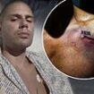 Max George gives update from his hospital bed after his veins collapse during terrifying 2.5 hour emergency heart surgery