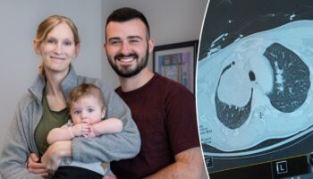 Pregnant woman and baby saved after doctors find grapefruit-sized tumor: 'Extremely rare'