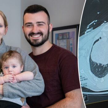 Pregnant woman and baby saved after doctors find grapefruit-sized tumor: ‘Extremely rare’