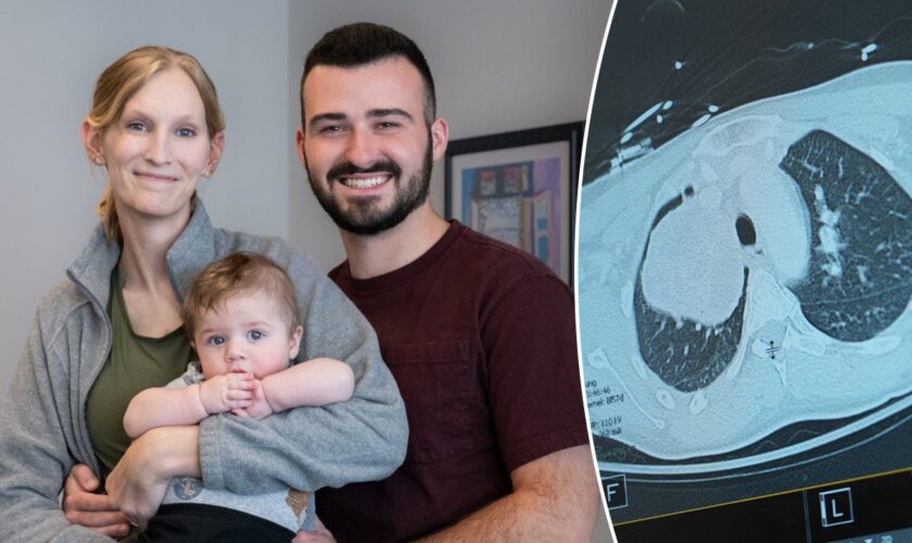 Pregnant woman and baby saved after doctors find grapefruit-sized tumor: 'Extremely rare'