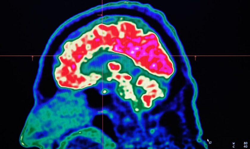 Scientists measure exact speed of human thought and the results are surprising