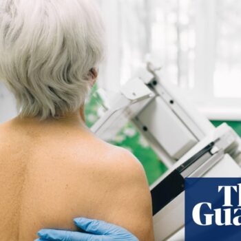 Cancer screening take ups not back to pre-pandemic levels, charity warns