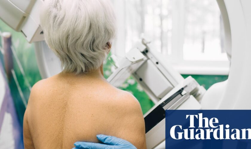 Cancer screening take ups not back to pre-pandemic levels, charity warns