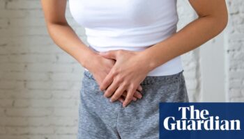 Endometriosis treatment to be subsided by federal government as health minister says ‘women are suffering unnecessarily’