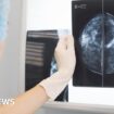 Early cancer diagnosis in England at record level, NHS figures show