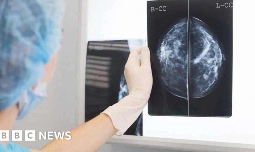 Early cancer diagnosis in England at record level, NHS figures show