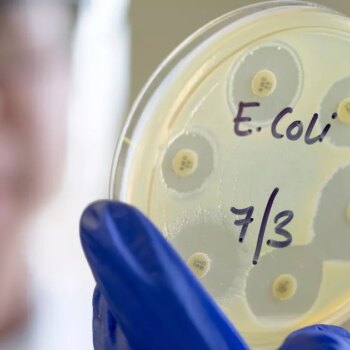 Rise in superbugs blamed on one thing – and there’s no getting away from them